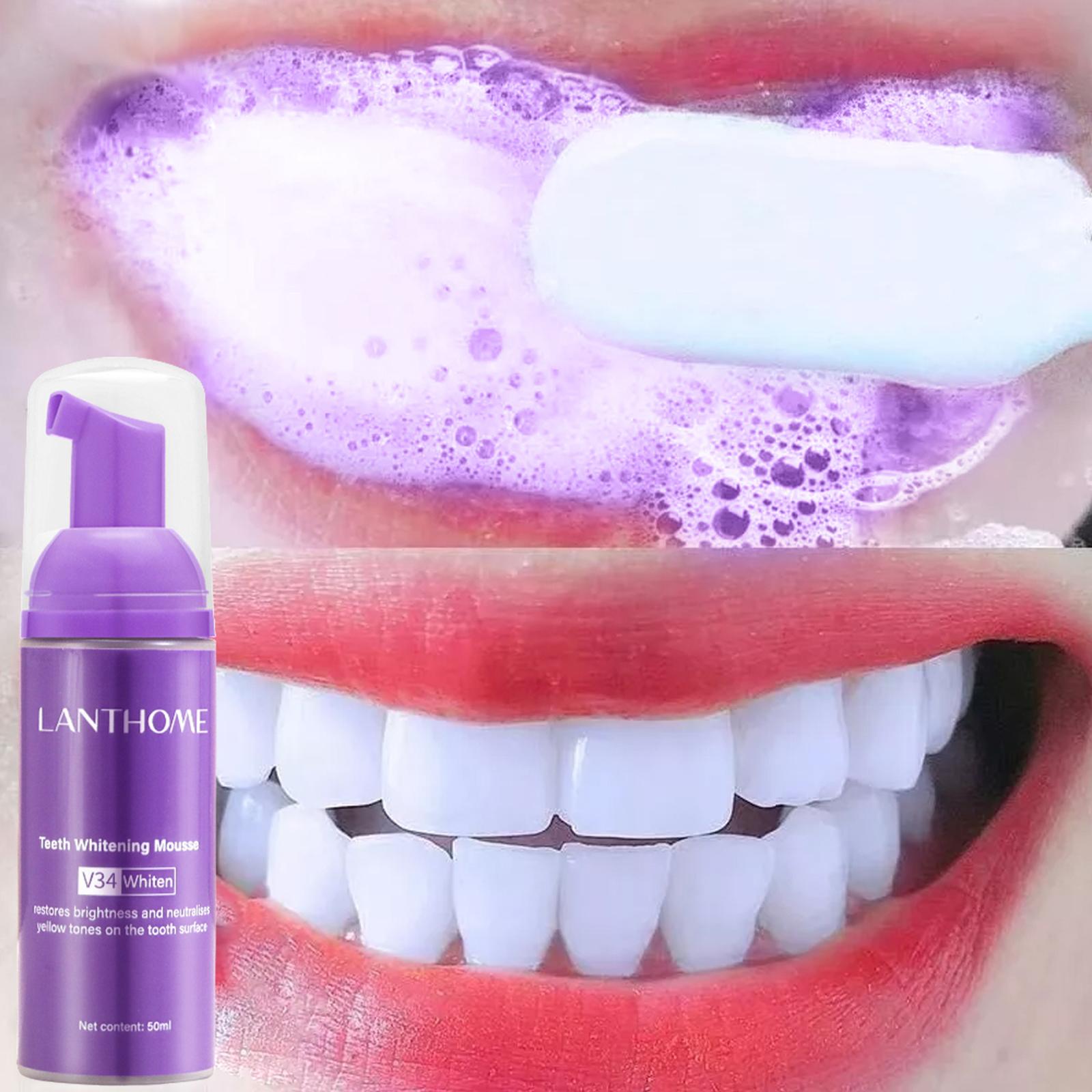 Teeth Whitening Crest - V34 mousse limpeza dos dentes pasta
