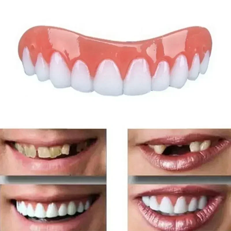 Teeth Whitening Veneers - Novas Próteses Dentárias de Silicone, Facetas