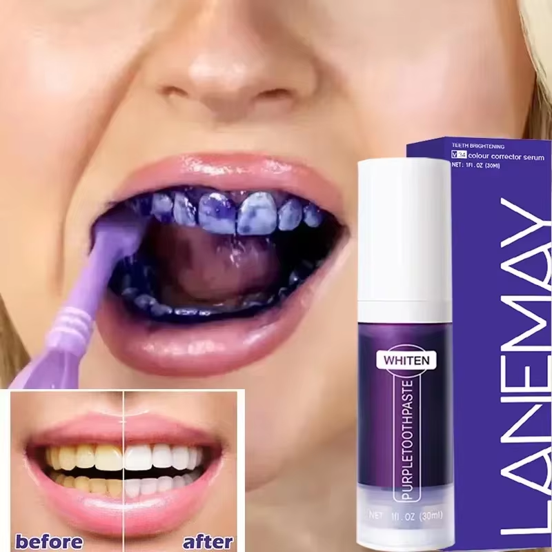 Teeth Whitening Crest - V34 roxo dentes branqueamento creme dental