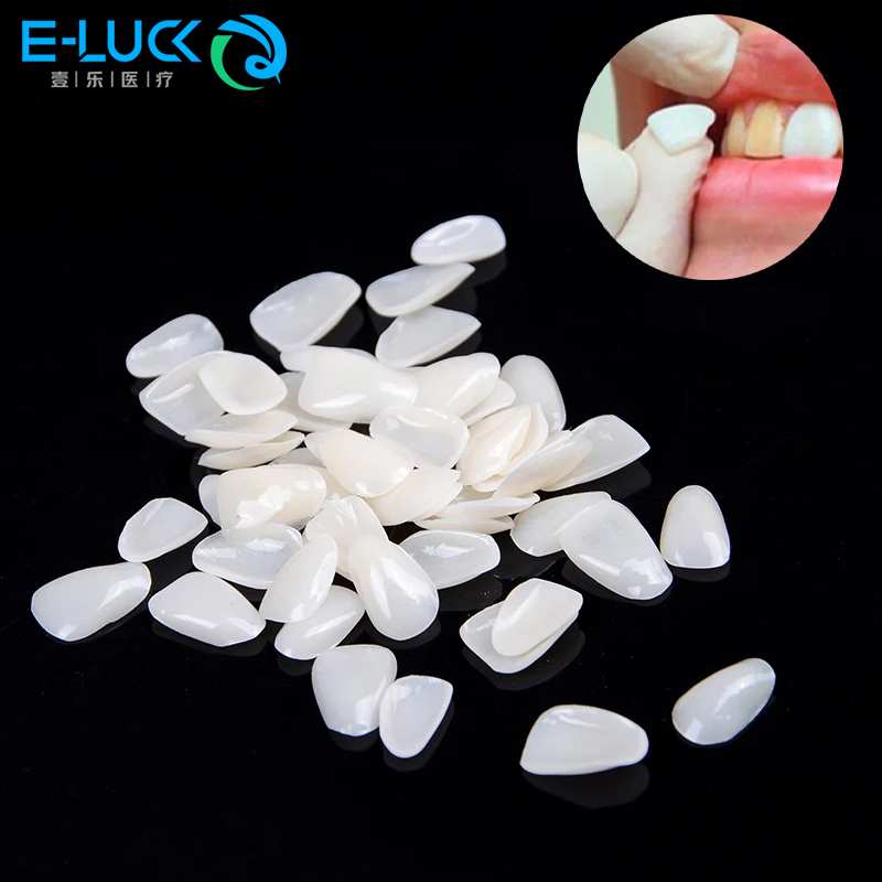 Teeth Whitening Veneers - 50 pçs folheados de dentes dentários