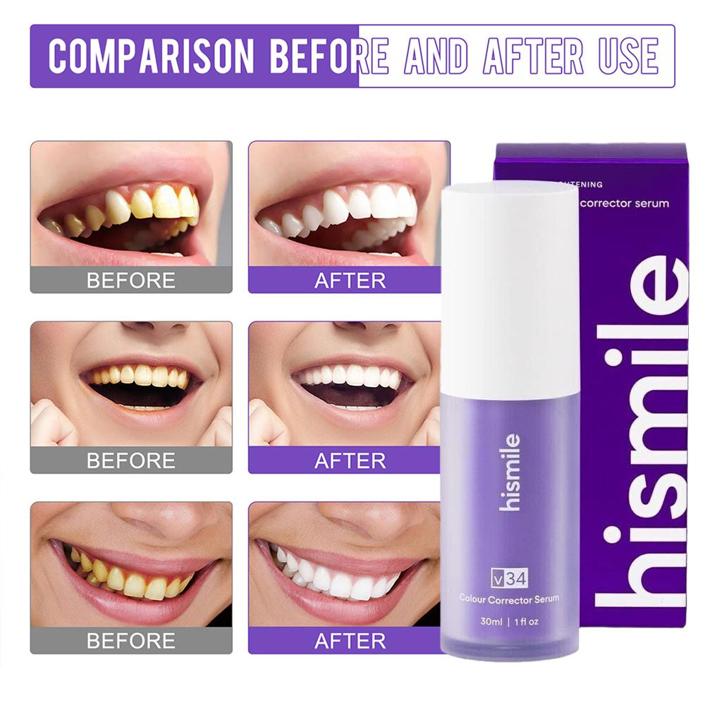 Teeth Whitening Crest - Espuma Clareadora de Dentes Hismile V34