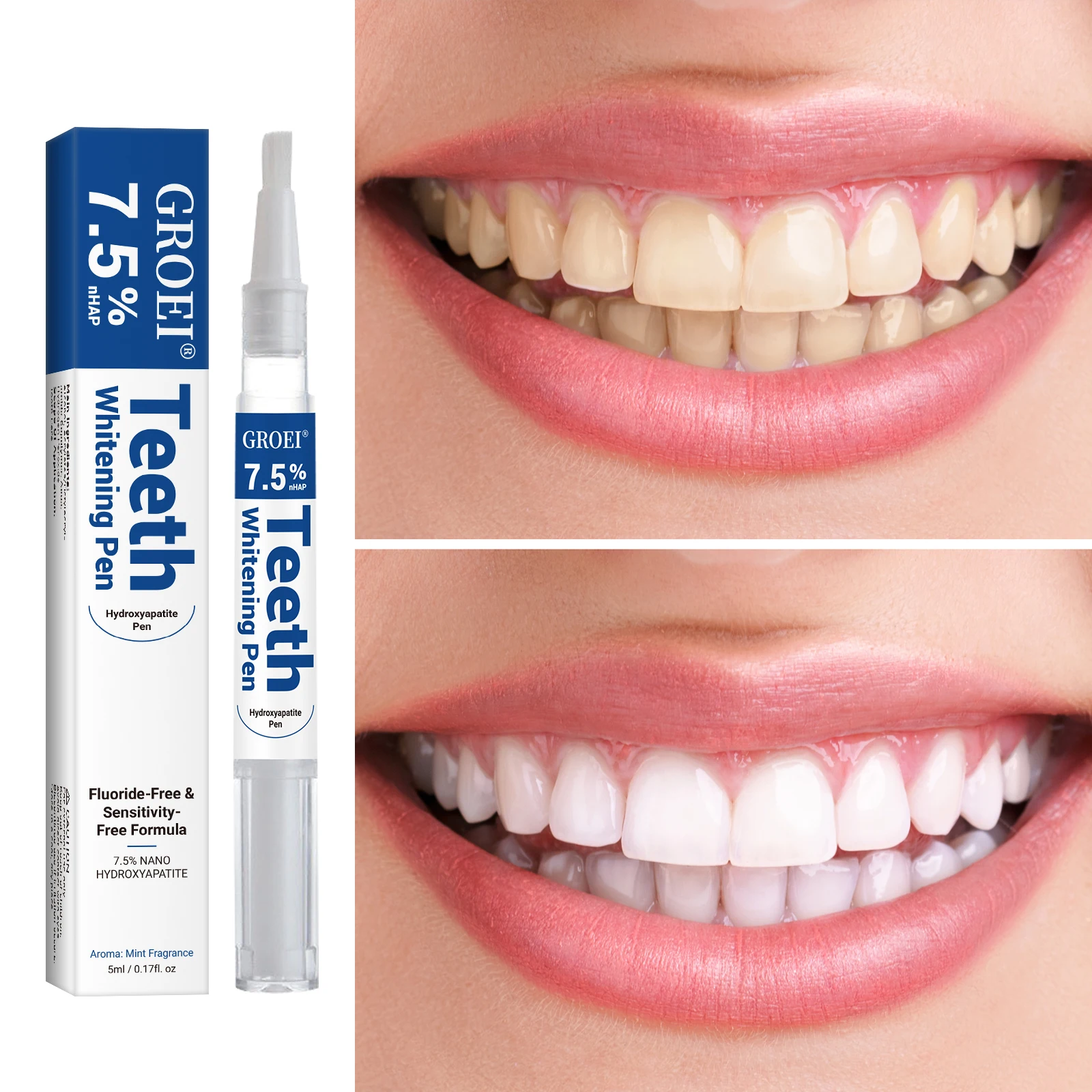 Caneta branqueadora de dente h - Teeth Whitening Ulta avaliação e preço