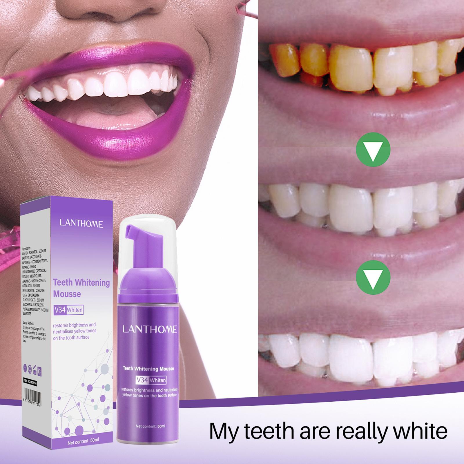 V34 mousse limpeza dos dentes  - Teeth Whitening Crest avaliação e preço