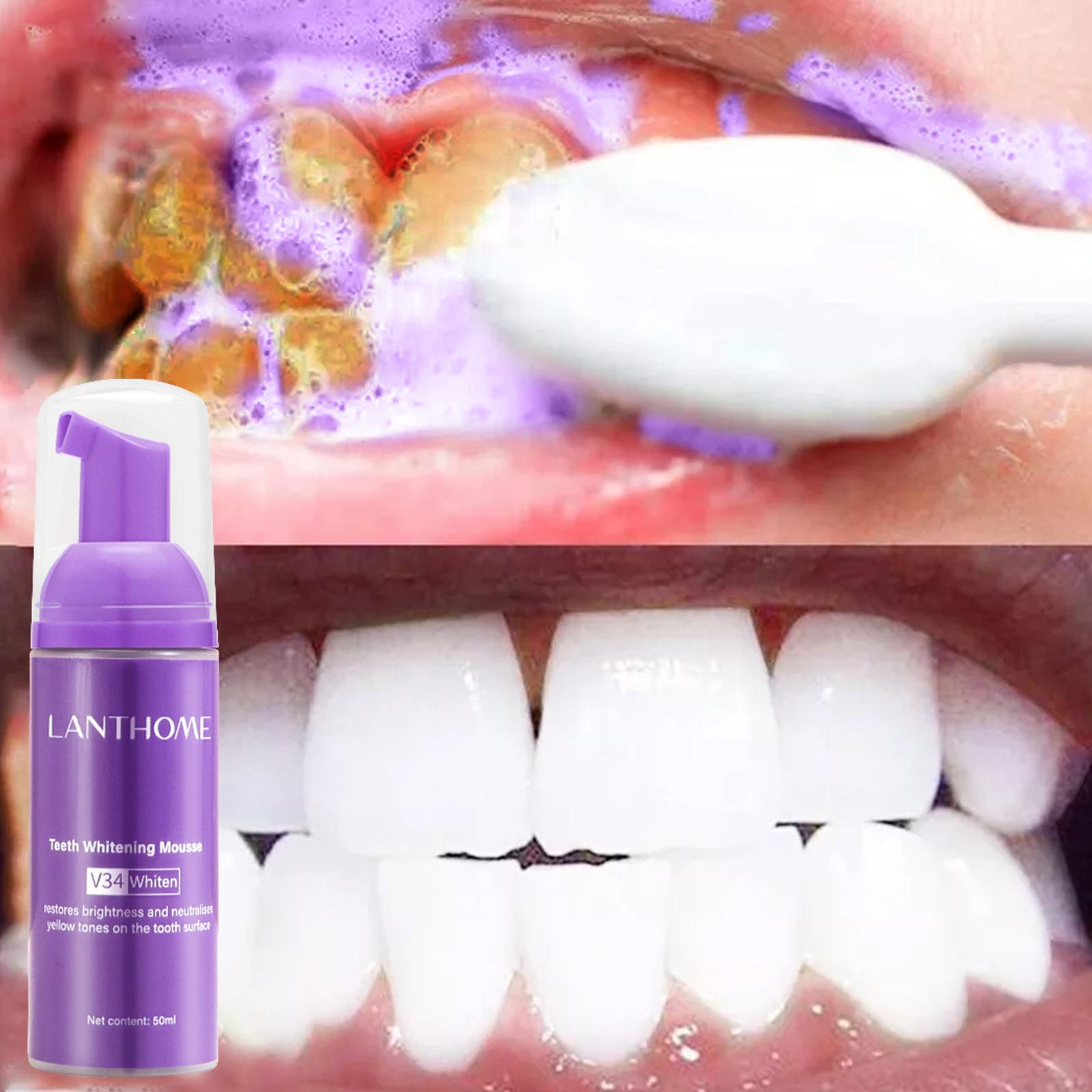 V34 mousse limpeza dos dentes  - Teeth Whitening Crest avaliação e preço