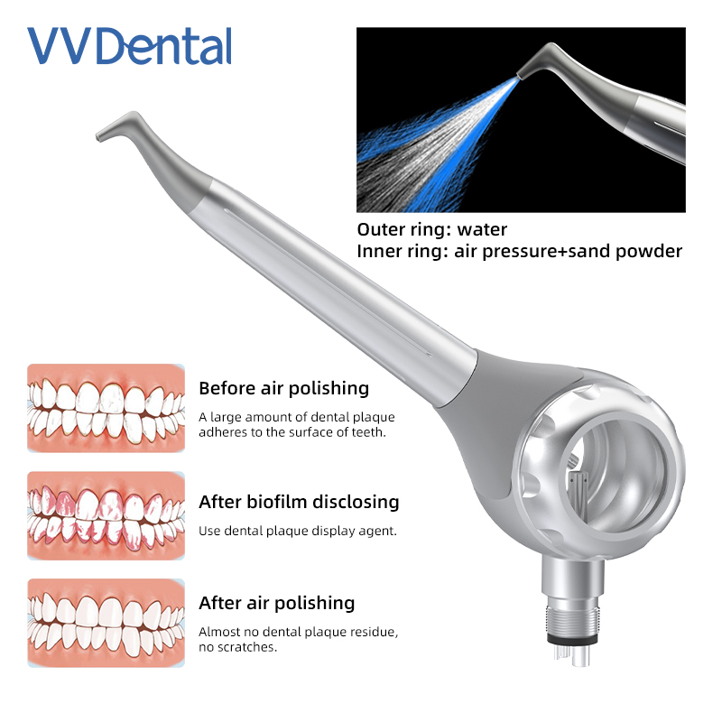Pistola de Jateamento Dental V - Teeth Whitening Dental avaliação e preço