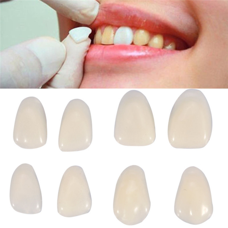 Dentes falsos dentários, coroa - Teeth Whitening Veneers avaliação e preço