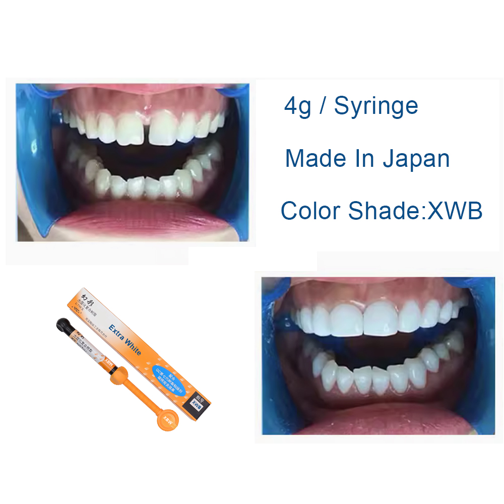 Resina Composta Dental Extra B - Teeth Whitening Veneers avaliação e preço
