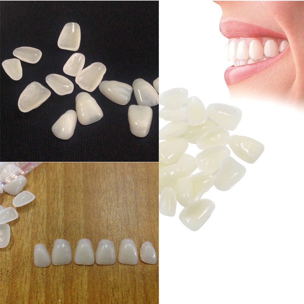 70 Peças/Pacote de Facetas Den - Teeth Whitening Veneers avaliação e preço